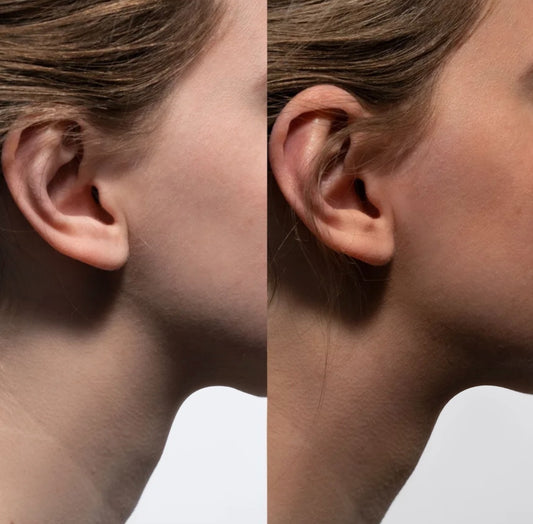 Isla Breeze Self-Tanning Mist